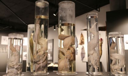 Museu do Pênis é atração com cerca de 600 falos verdadeiros na Islândia